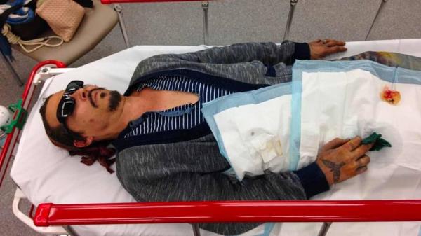 Опубликовано фото окровавленного Джонни Деппа, лежащего на носилках после драки с Эмбер Херд