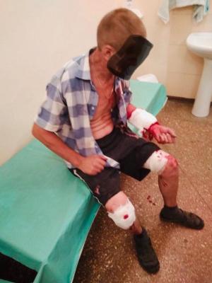 Военная сводка: обстрелами ВСУ ранен мирный житель Зайцево